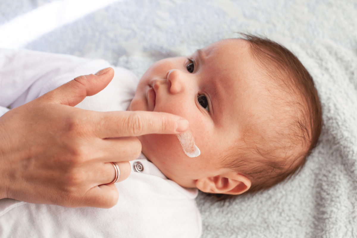 atopijski dermatitis kod beba